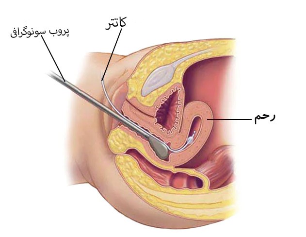 سونو در آب کلینیک تصویربرداری صبا