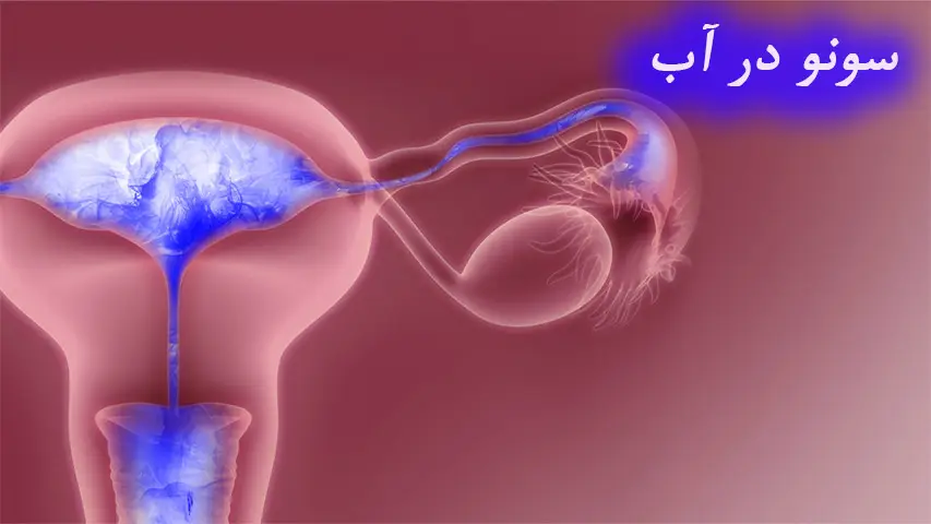 سونو درآب کلینیک تصویربرداری صبا