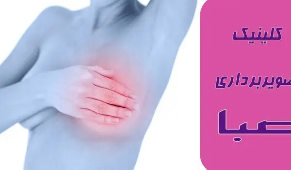 کیست پستان، کلینیک تصویربرداری صبا